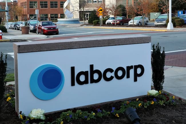 labcorp lunch hours